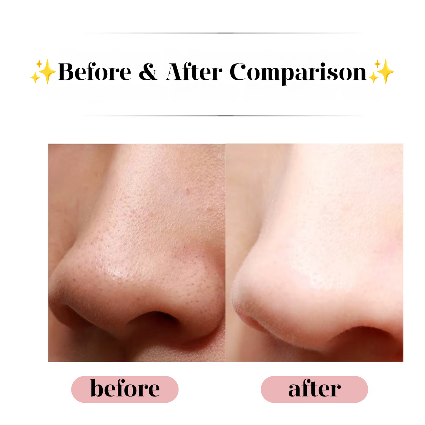 Ultrasonic Skin Scrubber
